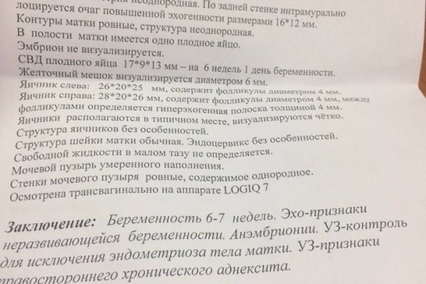 Kraken ссылка krakentor site